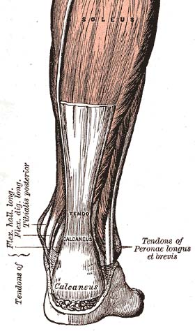 Treatment of myotendinous achilles ruptures.