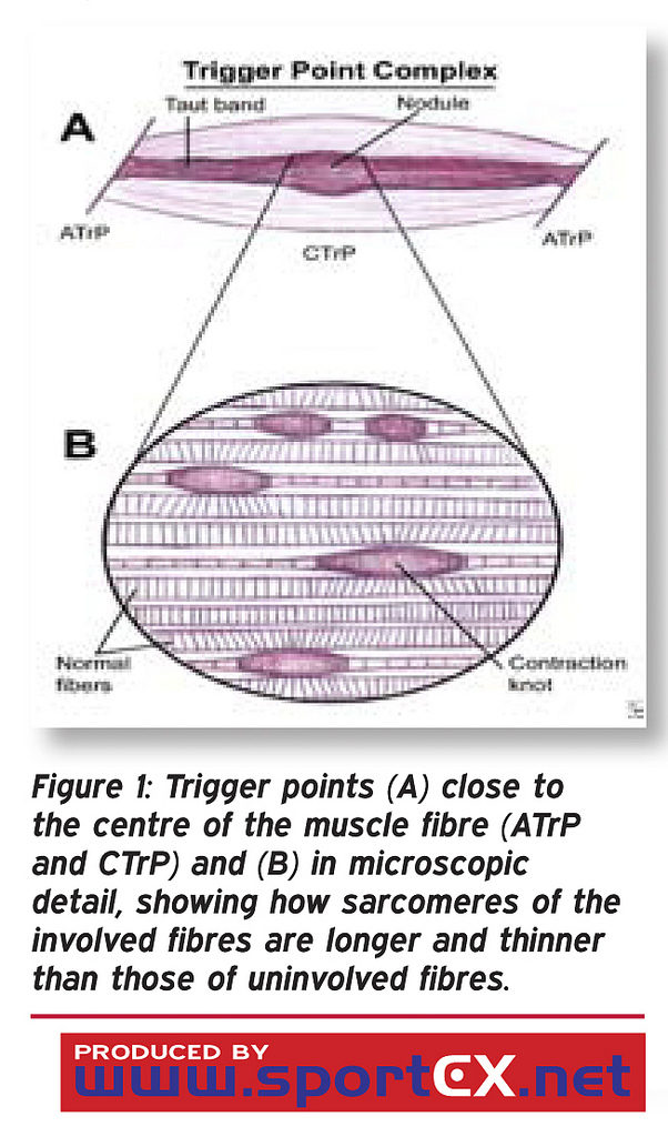 Neuroscience education in addition to trigger point dry needling for the management of patients with mechanical chronic low back pain Neuroscience education in addition to trigger point dry needling for the management of patients with mechanical chronic low back pain