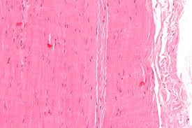 Negative Poisson's ratios in tendons: An unexpected mechanical response. Negative Poisson's ratios in tendons: An unexpected mechanical response.