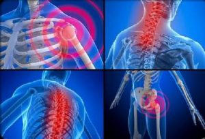 Resistance exercise improves muscle strength, health status and pain intensity in fibromyalgia Resistance exercise improves muscle strength, health status and pain intensity in fibromyalgia
