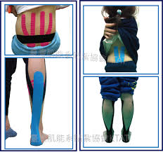 Effects of Kinesio(®) taping on skeletal muscle strength Effects of Kinesio(®) taping on skeletal muscle strength