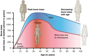 Nephrolithiasis, bone mineral density, osteoporosis, and fractures: a systematic review and comparative meta-analysis. Nephrolithiasis, bone mineral density, osteoporosis, and fractures: a systematic review and comparative meta-analysis.