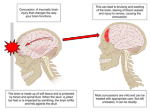 A practical concussion physical examination toolbox A practical concussion physical examination toolbox