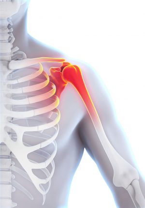 OPEN ACCESS: Assessment of reliability of ultrasound scanning to measure the humeral head in a number of GHJ positions OPEN ACCESS: Assessment of reliability of ultrasound scanning to measure the humeral head in a number of GHJ positions