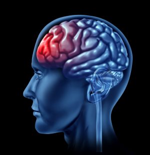 TBI and Treatment Response in a Randomized Trial of Acceptance and Commitment Therapy. TBI and Treatment Response in a Randomized Trial of Acceptance and Commitment Therapy.