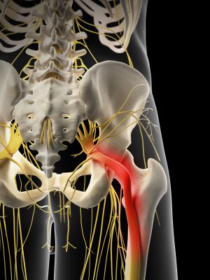 Pain expectations in neuropathic pain: Is it best to be optimistic? Pain expectations in neuropathic pain: Is it best to be optimistic?
