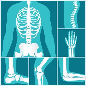 New NICE Guidance on Osteoporosis New NICE Guidance on Osteoporosis