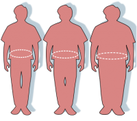 Physiotherapists demonstrate weight stigma Physiotherapists demonstrate weight stigma