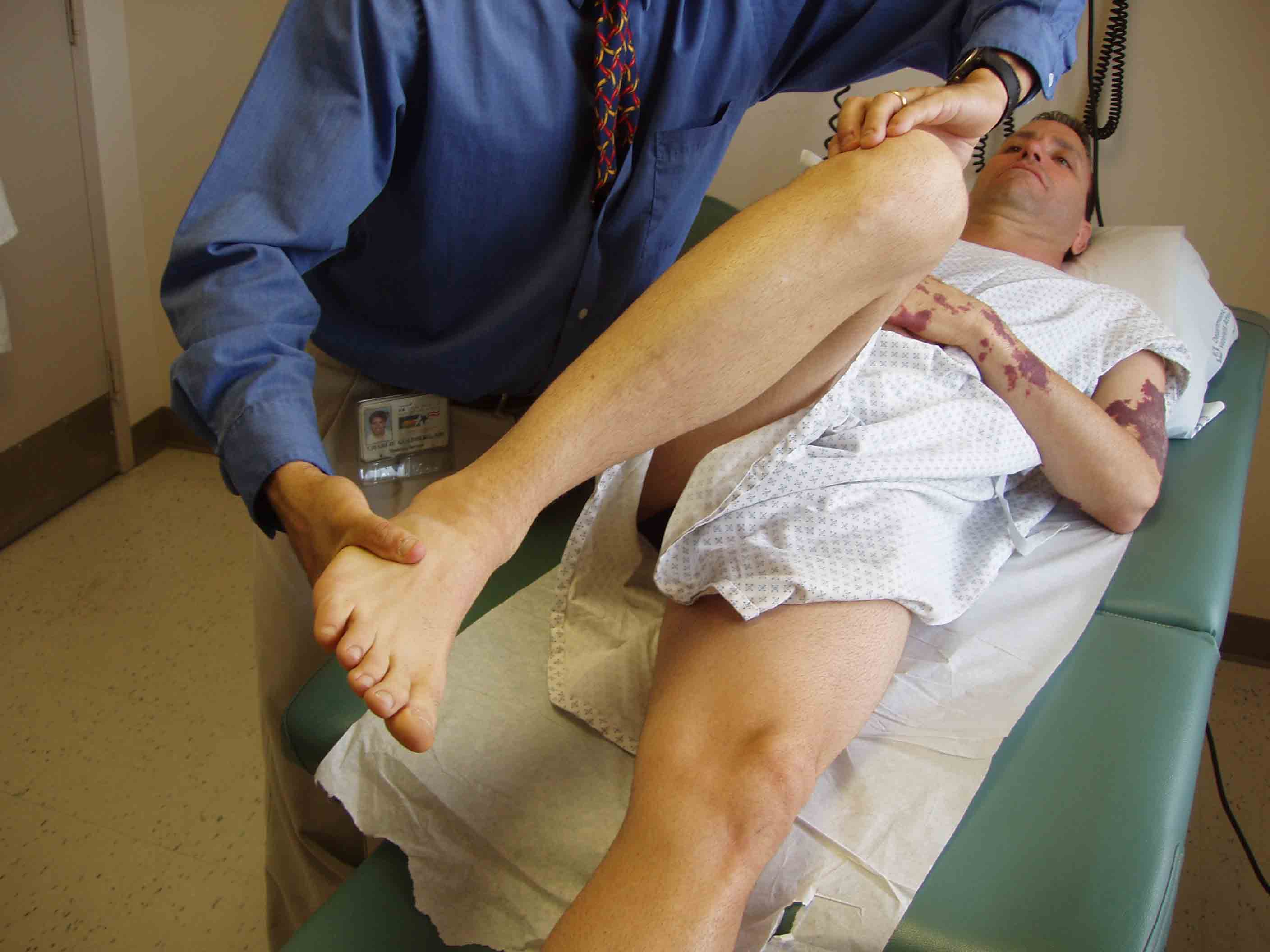 Joint Line Tenderness and McMurray Tests for the Detection of Meniscal Lesions Joint Line Tenderness and McMurray Tests for the Detection of Meniscal Lesions