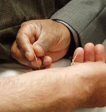 Physiologic effects of dry needling. Physiologic effects of dry needling.