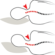 Time to stabilisation of the cervical spine when supported by a pillow in side lying Time to stabilisation of the cervical spine when supported by a pillow in side lying