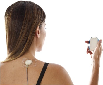 Design and evaluation of a wearable self-applied therapeutic ultrasound device for chronic myofascial pain. Design and evaluation of a wearable self-applied therapeutic ultrasound device for chronic myofascial pain.