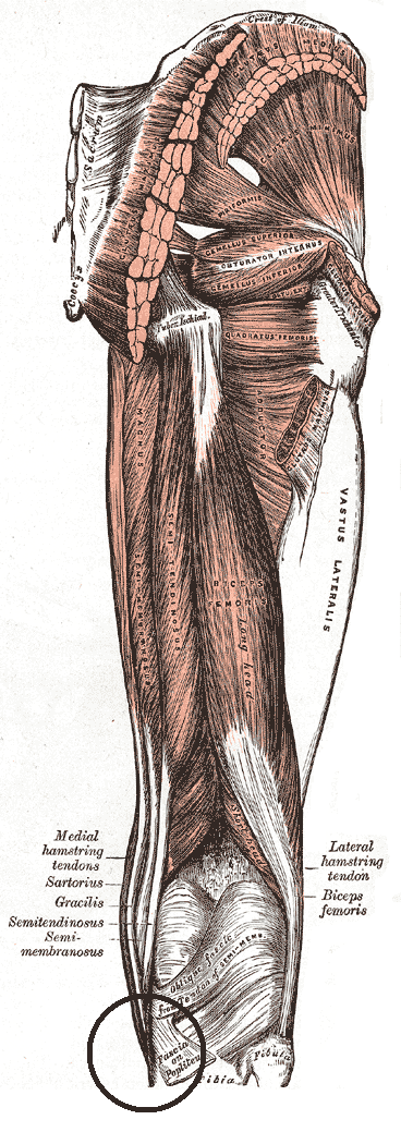 Biomechanical risk factors associated with iliotibial band syndrome in runners: a systematic review. Biomechanical risk factors associated with iliotibial band syndrome in runners: a systematic review.