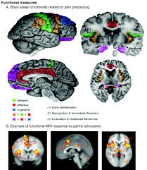 Are pain-related fears mediators for reducing disability and pain in patients with complex regional pain syndrome type 1? Are pain-related fears mediators for reducing disability and pain in patients with complex regional pain syndrome type 1?