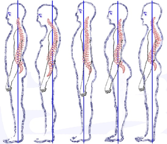 Dynamic Postural Control in Female Athletes and Non-Athletes following a Whole-Body Fatigue Protocol. Dynamic Postural Control in Female Athletes and Non-Athletes following a Whole-Body Fatigue Protocol.