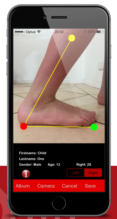 Save Time During Paedicatric assessment with the new Toes2Hip app Save Time During Paedicatric assessment with the new Toes2Hip app