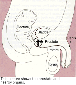 Efficacy of physiotherapy for urinary incontinence following prostate cancer surgery Efficacy of physiotherapy for urinary incontinence following prostate cancer surgery