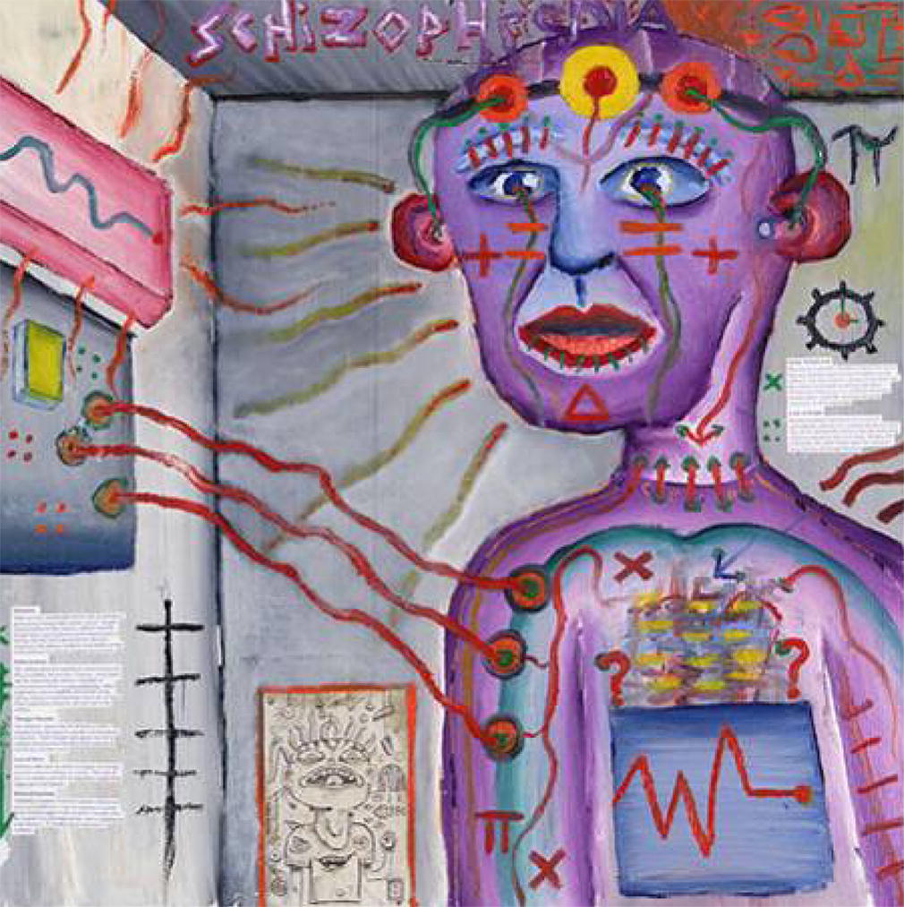The prevalence and moderators of clinical pain in people with schizophrenia The prevalence and moderators of clinical pain in people with schizophrenia