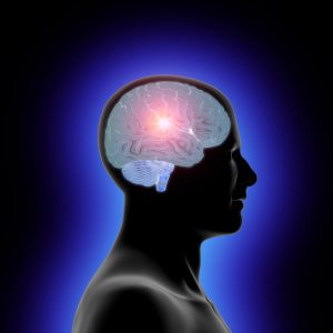A Classification System to Guide Physical Therapy Management in Huntington Disease: A Case Series. A Classification System to Guide Physical Therapy Management in Huntington Disease: A Case Series.