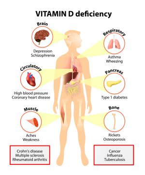 Vitamin D and falls - the dosage conundrum. Vitamin D and falls - the dosage conundrum.