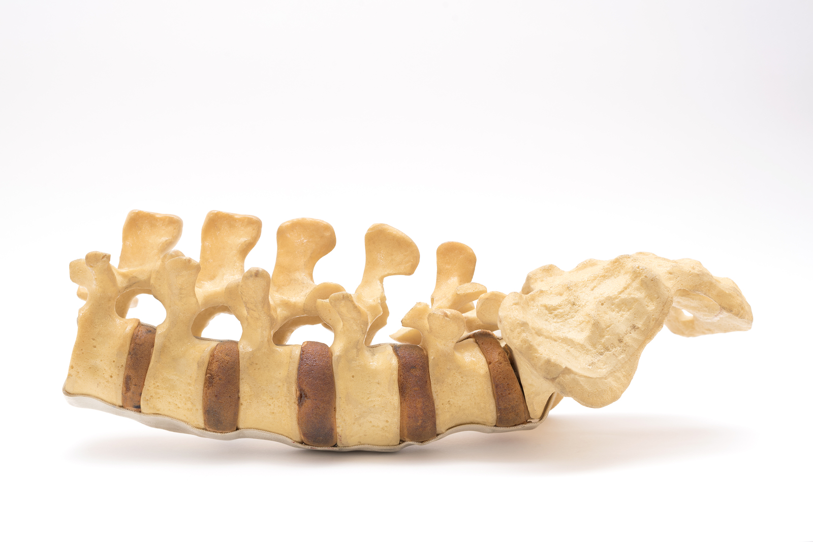 Lumbar Spine Model