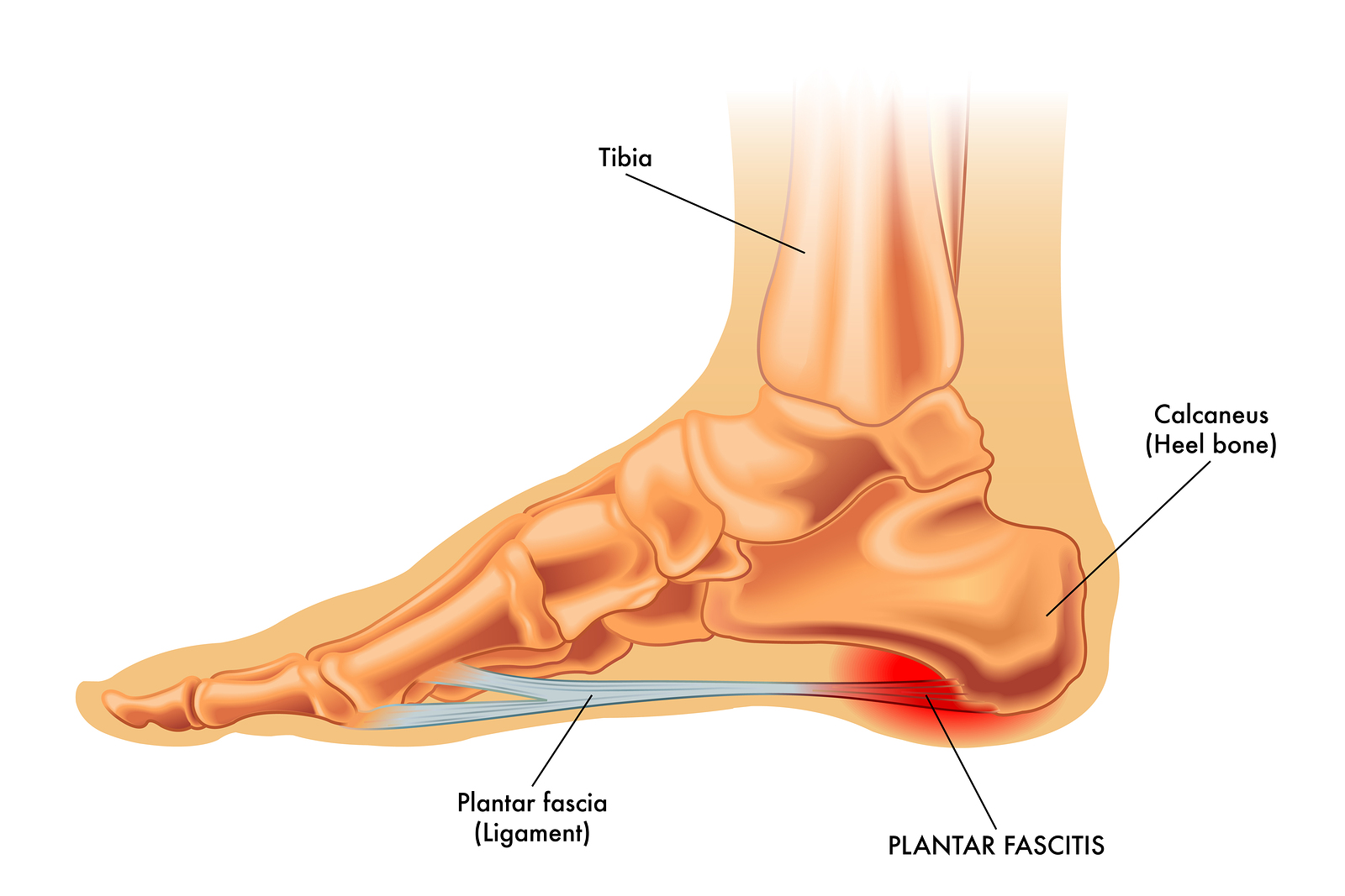 Effectiveness of Simultaneous Stretching of the Achilles Tendon ... Biology Diagrams