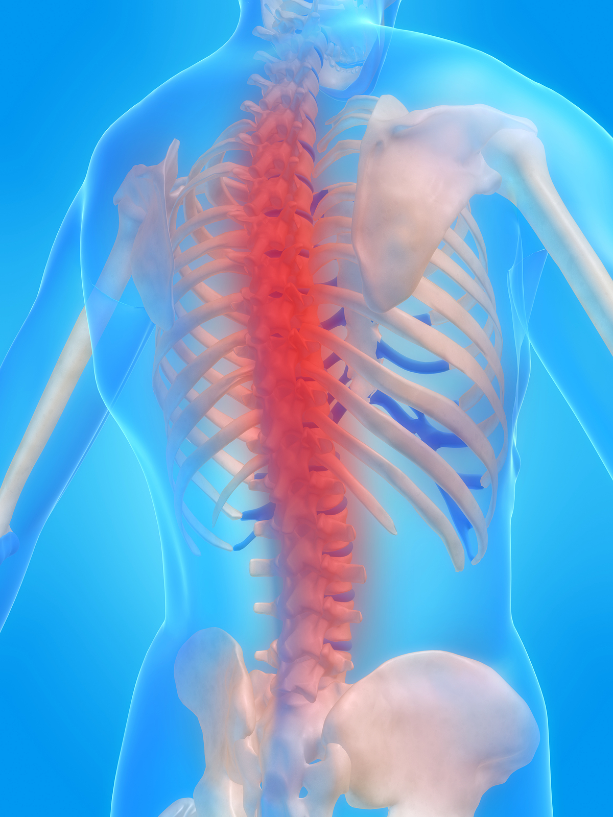 Painful Spine