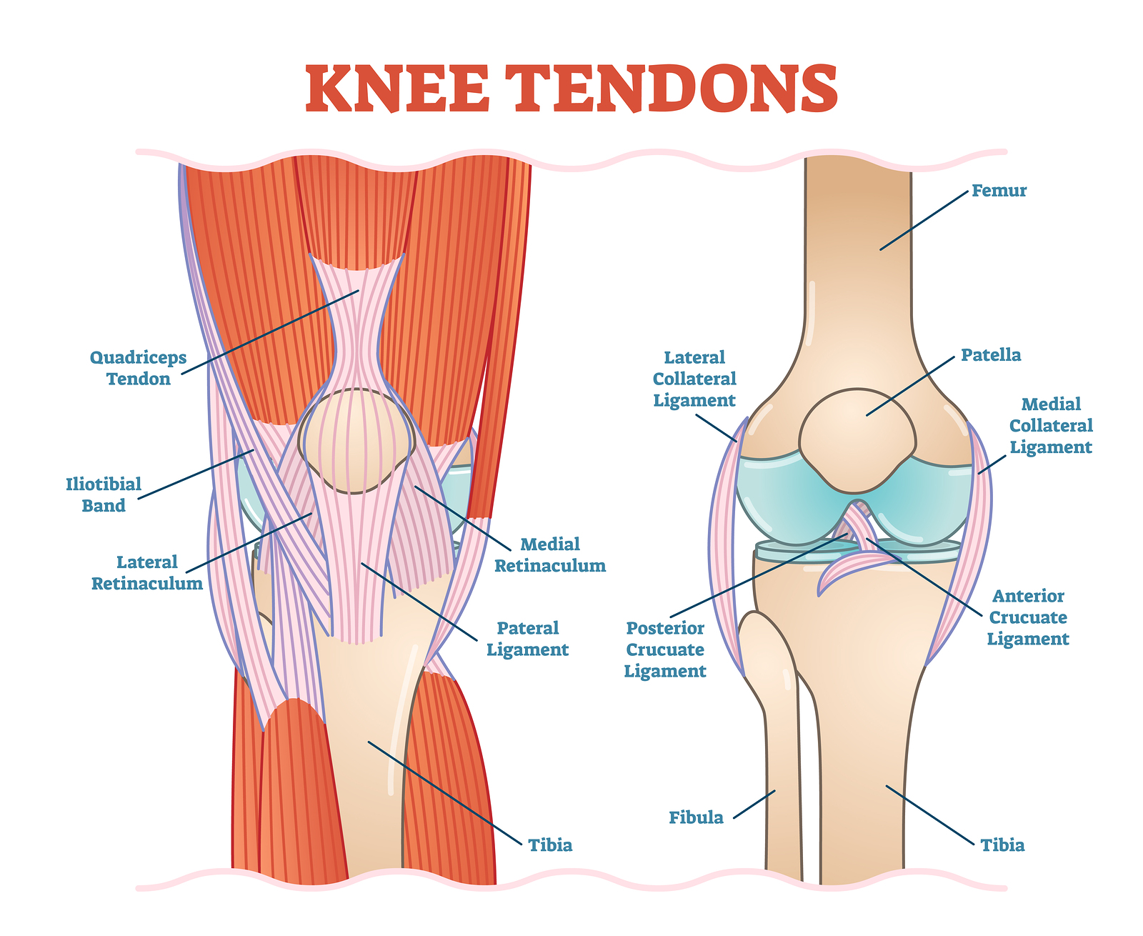 Changes on Tendon Stiffness & Clinical Outcomes in Athletes Are