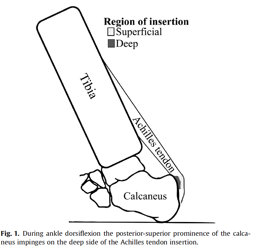 heel lifts achilles tendonitis