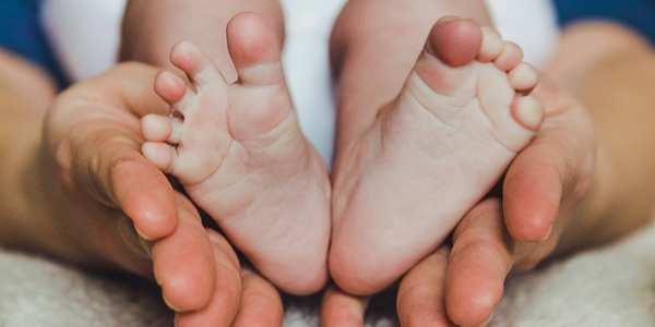 managing children with clubfoot MOOC - online course for physiotherapy and physical therapy