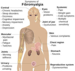 Fibromyalgia symptoms