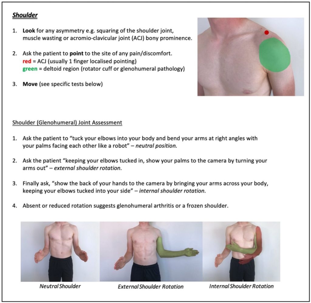 A shoulder resource guide for teleheath consultations including useful communication techniques for patient positioning.