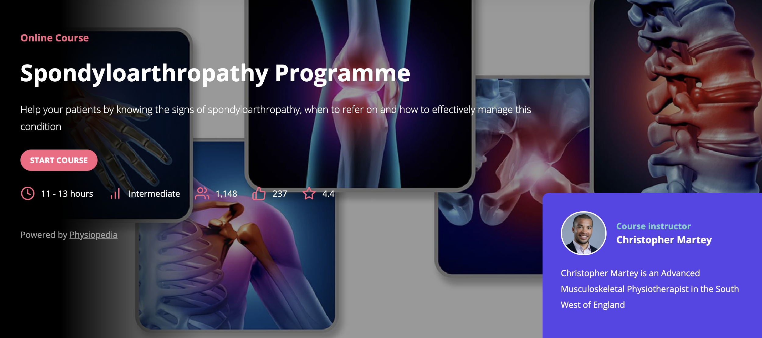 Image to promote Spondyloarthropathy programme of courses on Physiopedia Plus for World Arthritis Day